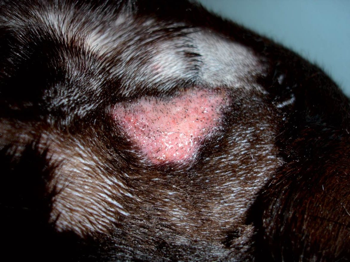 Fungal Infections