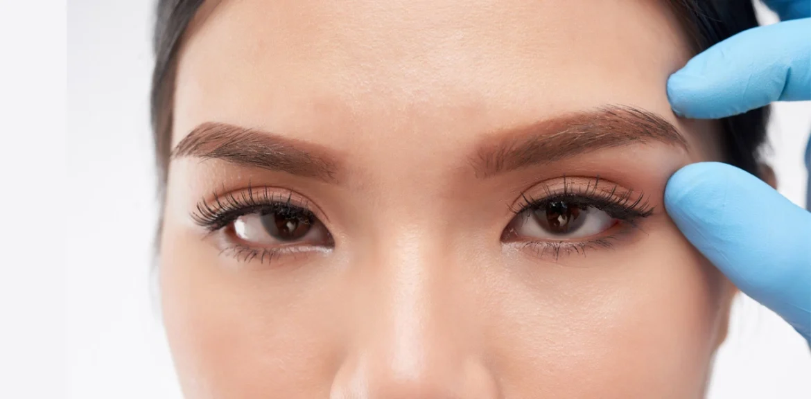 Endoscopic Brow Lift Houston TX